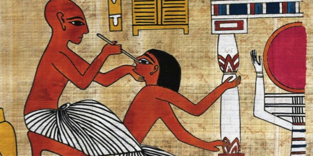  An ancient Egyptian surgeon uses a drill to remove a tumor from a patient's skull.